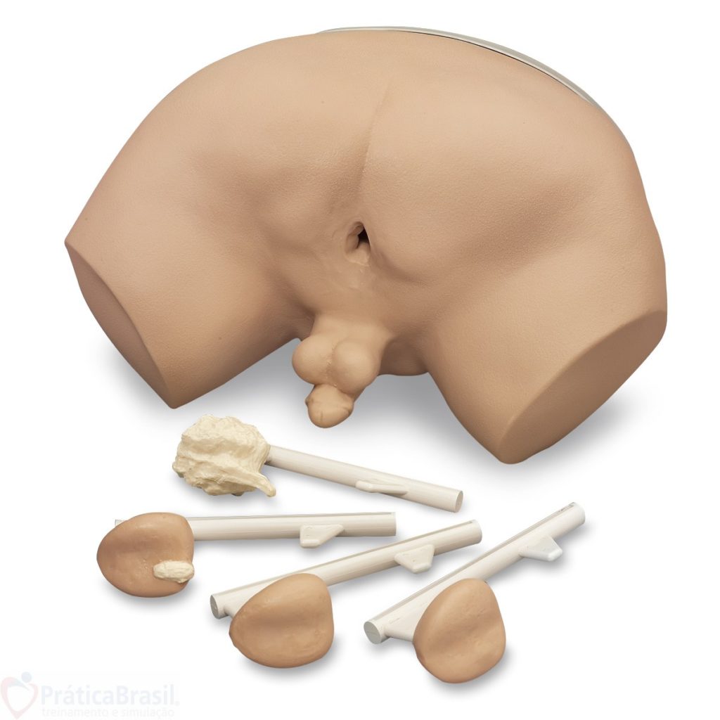 Exame de Próstata - Tire suas Dúvidas Aqui